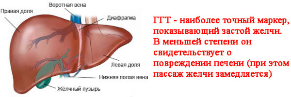 Холецистит бескаменный хронический. Cимптомы и лечение