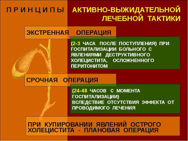 Холецистит калькулезный острый. Это что, лечение, клинические рекомендации