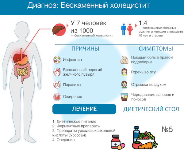 Некалькулезный холецистит. Что это такое, симптомы, лечение