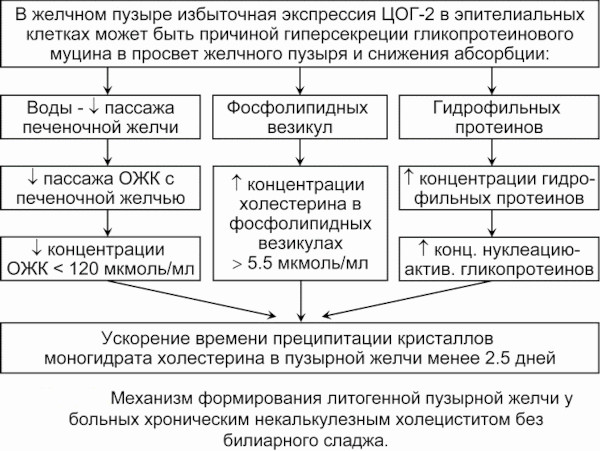 Некалькулезный холецистит. Что это такое, симптомы, лечение