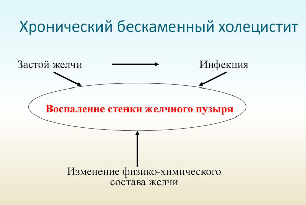 Некалькулезный холецистит. Что это такое, симптомы, лечение