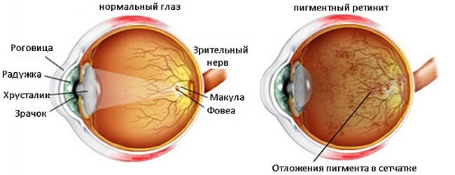 Игрель (Igrel) капли глазные. Инструкция по применению, цена, отзывы