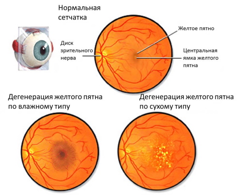 Игрель (Igrel) капли глазные. Инструкция по применению, цена, отзывы