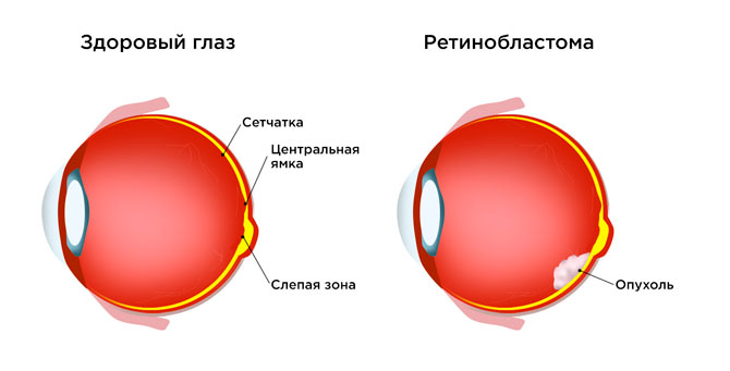 Игрель (Igrel) капли глазные. Инструкция по применению, цена, отзывы