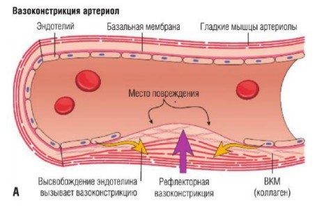 Инфаркт головного мозга и инсульт. Разница и отличия