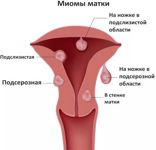 Лапаротомия. Это что такое, виды операции