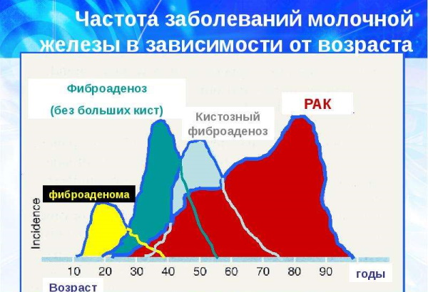 Листовидная фиброаденома молочной железы на УЗИ. Фото