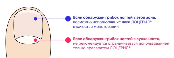 Лоцерил (Loceryl). Инструкция по применению, цена, отзывы