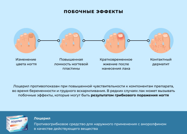 Лоцерил (Loceryl). Инструкция по применению, цена, отзывы