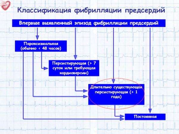 Пароксизмальная форма фибрилляции предсердий. Что это такое, лечение