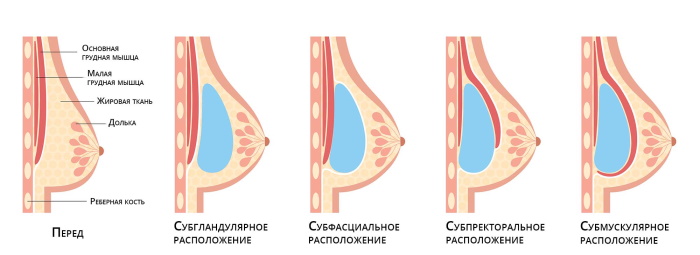 Почему чешутся соски у женщины. Причины зуда