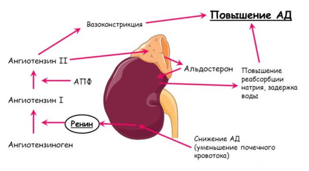 Симптоматическая артериальная гипертензия (вторичная). Что это такое