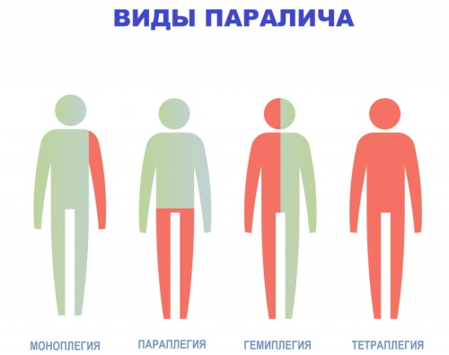 Последствия клещевого энцефалита головного мозга