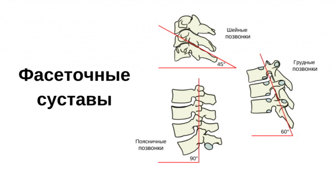 Спондилез грудного отдела позвоночника. Что это такое, симптомы, лечение