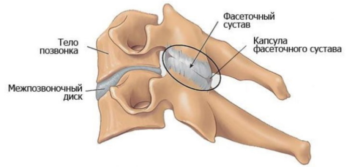 Спондилез грудного отдела позвоночника. Что это такое, симптомы, лечение