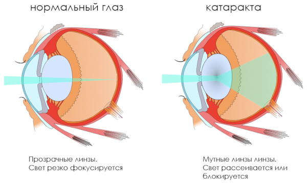 Таустин (Taustin) капли глазные. Инструкция по применению, цена, отзывы