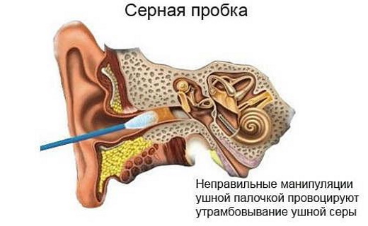 Отофаг гель и аналоги дешевле для детей. Отзывы