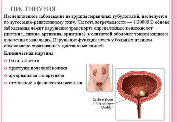 Уралит-У (Uralit-U). Инструкция по применению, цена, отзывы