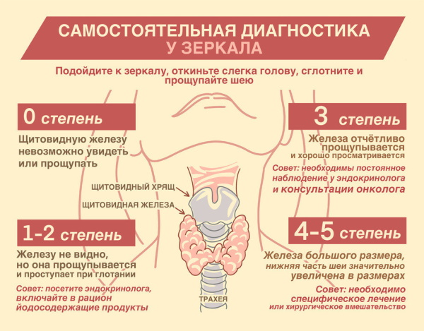 Узлы в щитовидной железе. Опасность, размер, норма, лечение