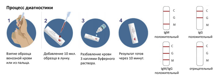 Антитела. Что такое в крови человека, анализы