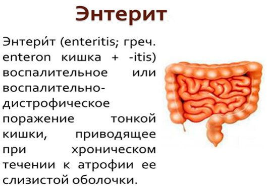 Болезни кишечника у мужчин. Симптомы, признаки