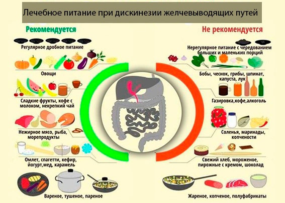 Дискинезия желчевыводящих путей по гипокинетическому типу. Что это, лечение