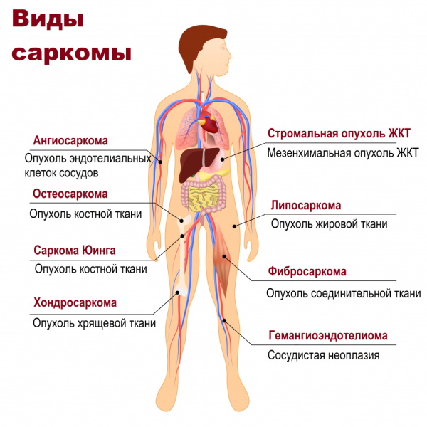 Ингаляции при бронхите у взрослых. Народные средства