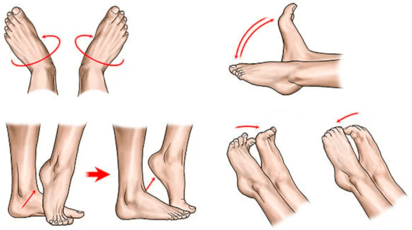 Лечение артроза стопы ног в домашних условиях