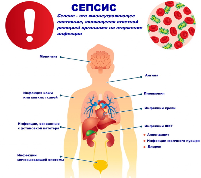 Туляремия. Возбудитель заболевания, симптомы, лечение