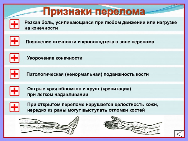 Открытый перелом руки. Первая помощь, сколько заживает