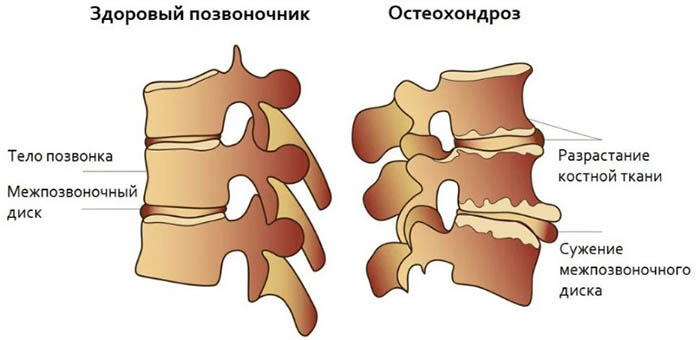 Тянет низ живота после месячных. Причины у женщин