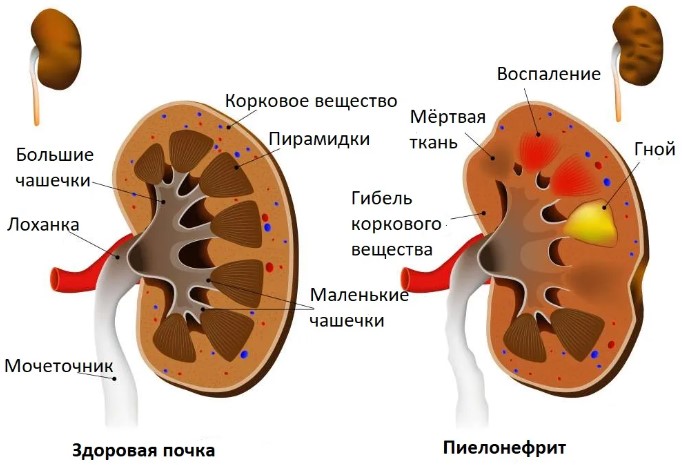 Тянет низ живота после месячных. Причины у женщин