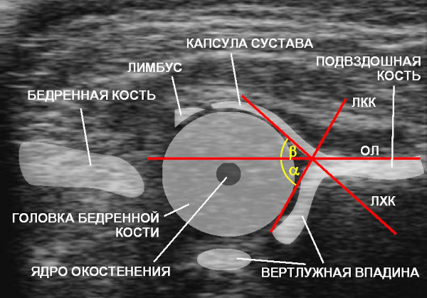 УЗИ тазобедренных суставов у взрослых. Что показывает, как делается