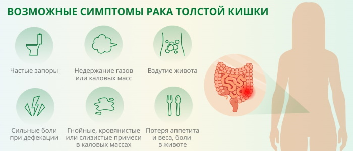 Заболевания кишечника. Симптомы и признаки у женщин