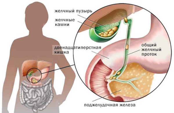 Абсцесс печени. Причины, что это, клинические рекомендации