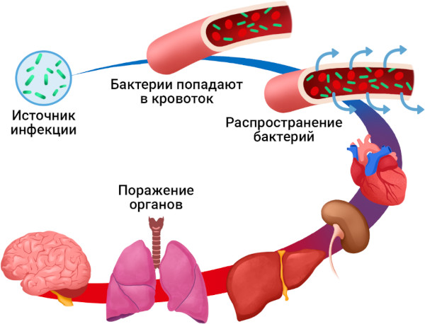 Абсцесс печени. Причины, что это, клинические рекомендации