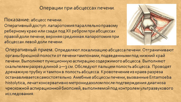 Абсцесс печени. Причины, что это, клинические рекомендации