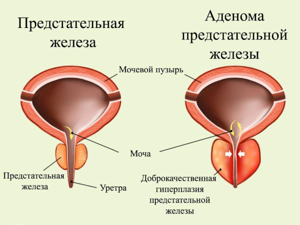 Алфупрост МР (Alfuprost MR). Инструкция по применению, цена, отзывы