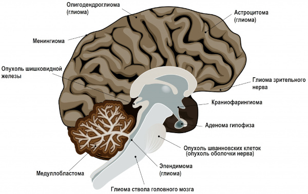 Анизокория это что в медицине. Причины, симптомы