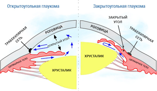 Анизокория это что в медицине. Причины, симптомы