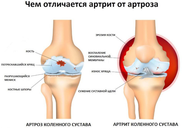 Артрофоон (Arthrofon) таблетки. Инструкция по применению, цена