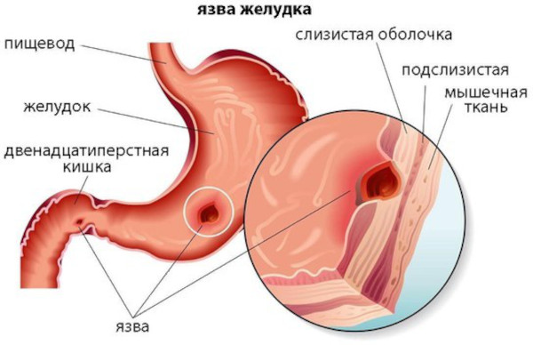 Артрофоон (Arthrofon) таблетки. Инструкция по применению, цена