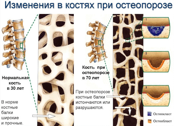 Артродарин (Artrodarin). Инструкция по применению, цена, отзывы