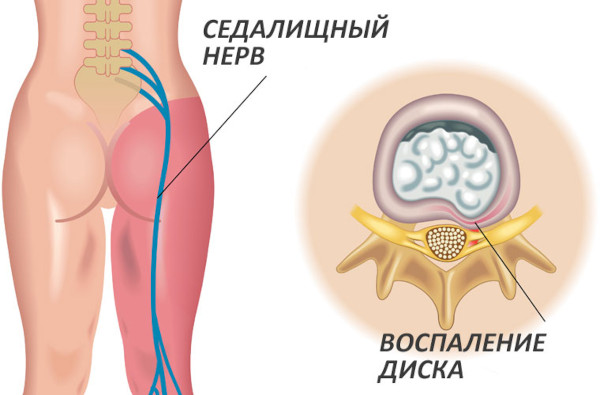 Калмирекс (Calmirex) таблетки. Инструкция по применению, цена