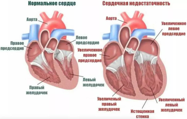 Коргликард (Corglycard) ампулы. Инструкция по применению