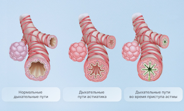 Косопт (Cosopt) глазные капли. Инструкция по применению, цена