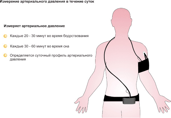 Дистрофия миокарда (миокардиодистрофия). Что это такое, симптомы, лечение