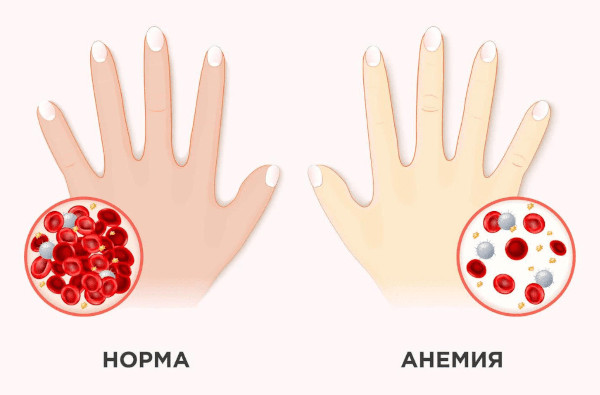 Эритропоэтин (Erythropoietin). Инструкция по применению, цена, отзывы