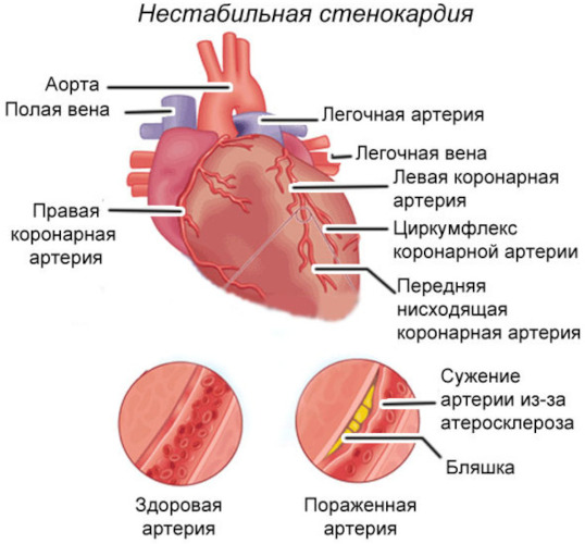 Эритропоэтин (Erythropoietin). Инструкция по применению, цена, отзывы