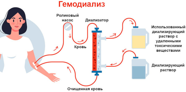 Эритропоэтин (Erythropoietin). Инструкция по применению, цена, отзывы